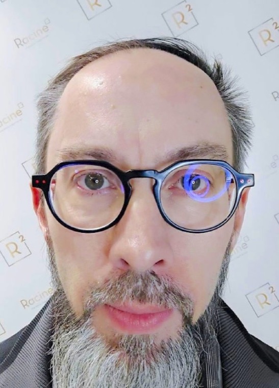 Avant Olivier
