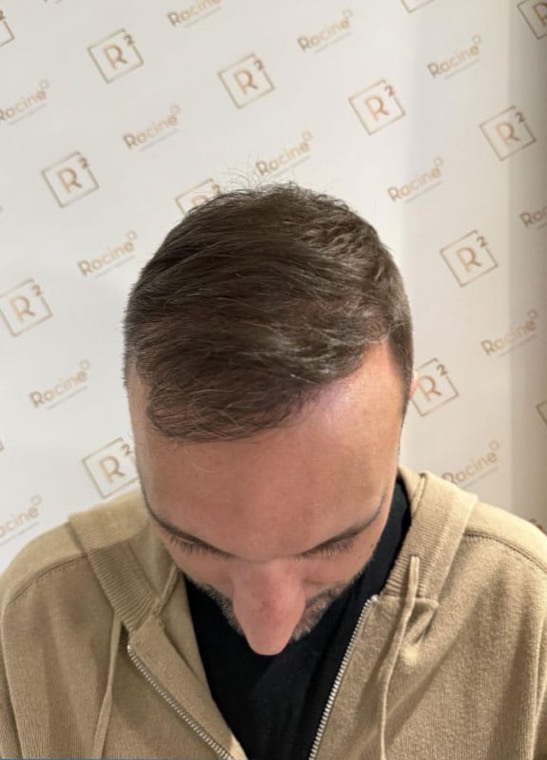 Après Luc