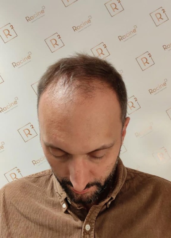 Avant Luc