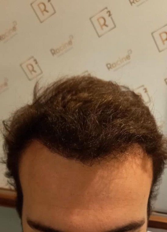 Après Yoann